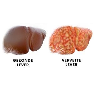 Gezonde lever - vervette lever